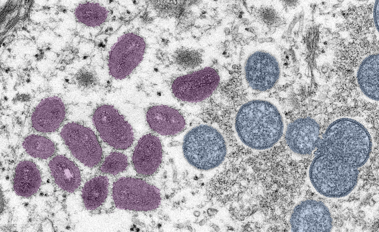 Read more about the article MONKEYPOX OUTBREAK IN 2022: WHAT SHOULD WE KNOW?